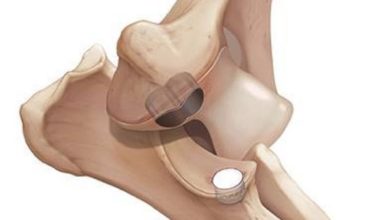 Davies offers new surgical procedure for canine elbow dysplasia