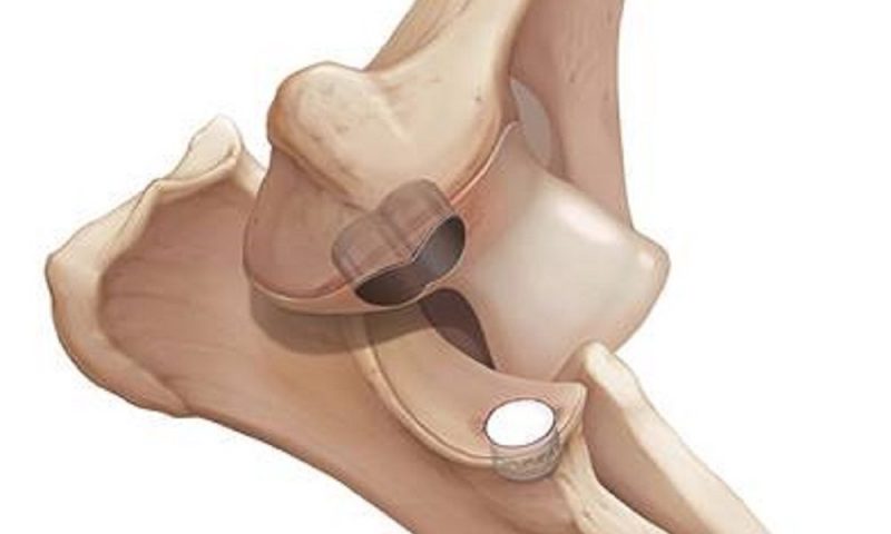 Davies offers new surgical procedure for canine elbow dysplasia